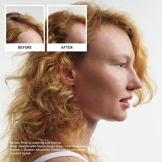 Scalp & Hair Thickening System for Thinning Hair, 3-Month Kit