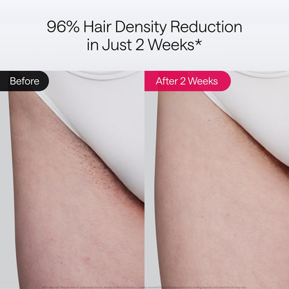 IPL Hair Removal Device with Ice-Cooling & Skin Sensor