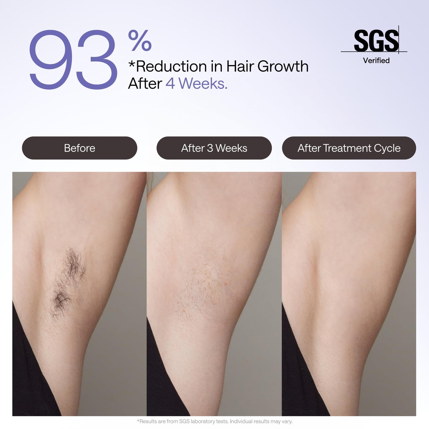 Ulike Air 4 IPL Hair Removal Device