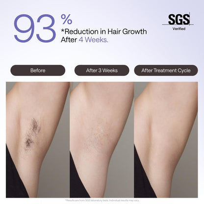 Ulike Air 4 IPL Hair Removal Device