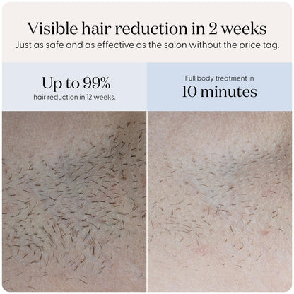 At-Home IPL Hair Removal Device for Face & Body