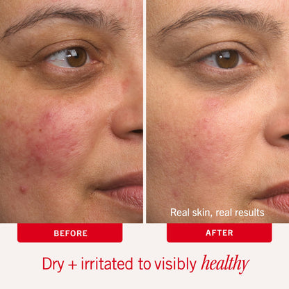 Intensive Face & Body Moisturizer for Dry, Sensitive Skin